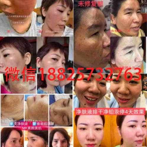 MK素顏美肌效果怎么樣,怎么代理的