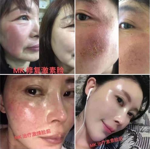 MK素顏美肌效果怎么樣,怎么代理的