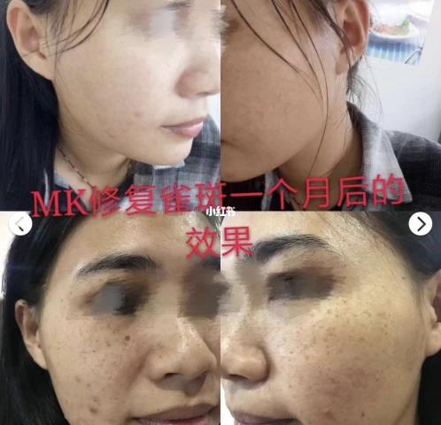 MK素顏美肌效果怎么樣,怎么代理的