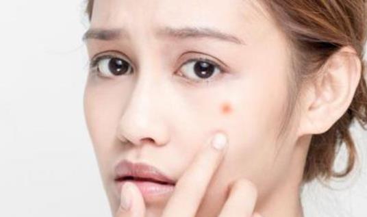長痘痘的人需要注意什么?長痘痘的人日常護(hù)理