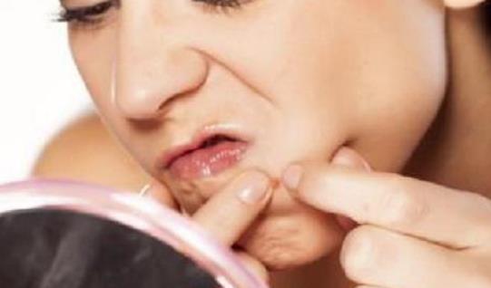 長痘痘的人需要注意什么?長痘痘的人日常護(hù)理