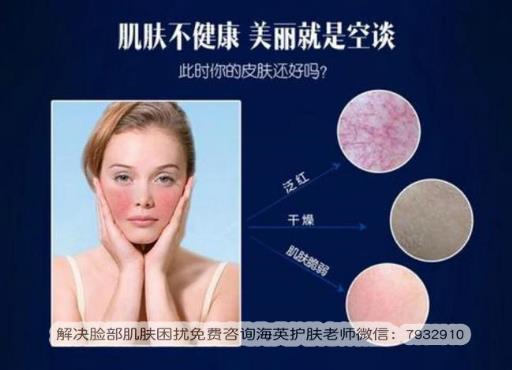 干性皮膚紅血絲怎么辦?朵嘉濃的護(hù)膚品真的能修復(fù)好皮膚嗎?