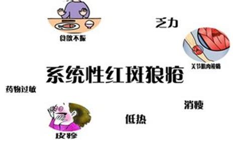 紅斑狼瘡激素臉怎么辦?朵嘉濃到底能修復皮膚嗎?