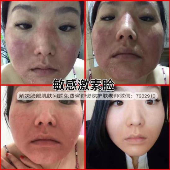 朵嘉濃修復產品真的有效果嗎?朵嘉濃效果怎么樣?