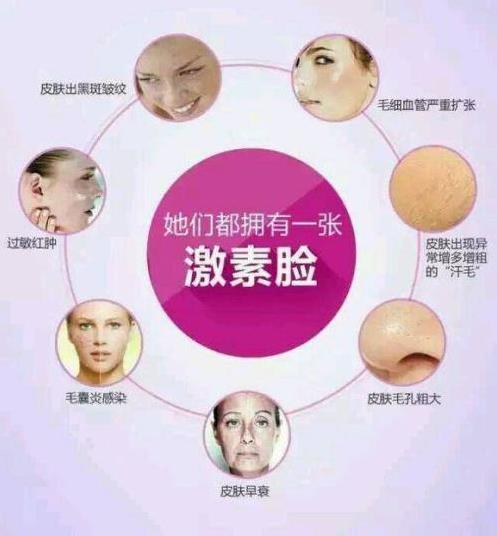 海英:激素臉是怎么形成的?激素臉怎么修復?激素臉的修復周期是多久?