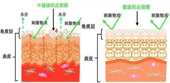 懷孕得了激素臉怎么辦?懷孕期間能用護膚品嗎?