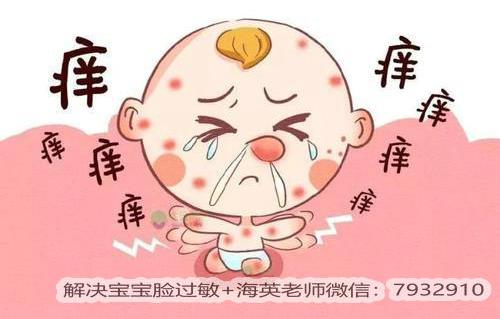 寶寶臉過敏可以用護膚品嗎?什么護膚品適合寶寶用?