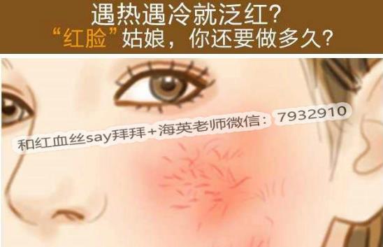 臉上有紅血絲怎么去除?改善紅血絲有什么好辦法嗎?