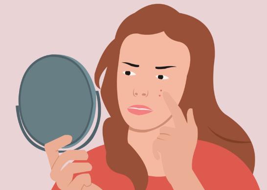 擠痘痘顱內感染會死嗎?擠痘痘顱內感染多久能看出來?