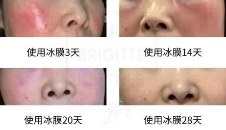 德國(guó)MBK“小綠瓶”|加快修復(fù)敏感肌
