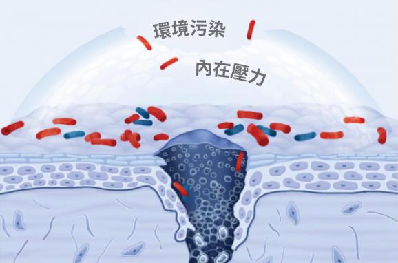 皮膚問題反復?Cn刷菌科學修復,掃除問題肌,刷新護膚新感受!