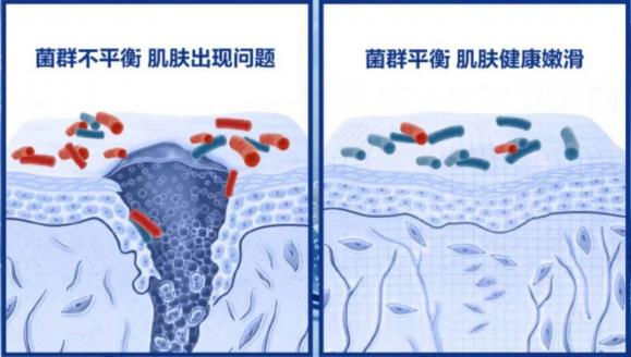 皮膚問題反復?Cn刷菌科學修復,掃除問題肌,刷新護膚新感受!