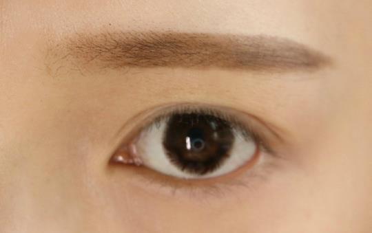 眉毛長痘痘怎么辦?兩眉中間長痘如何調理?