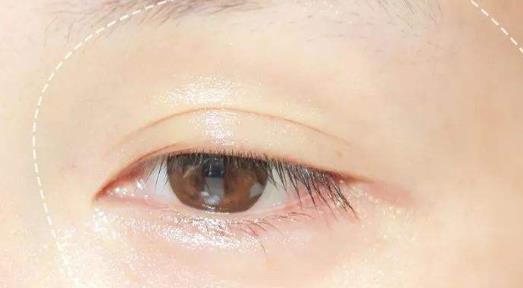 節(jié)后疲勞肌膚要做好護(hù)理 這些節(jié)后疲勞肌膚的護(hù)理方法要收好
