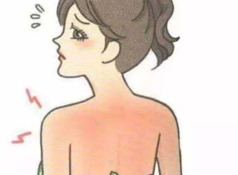 背部長痘不僅僅是難看 4個方法除痘效果好