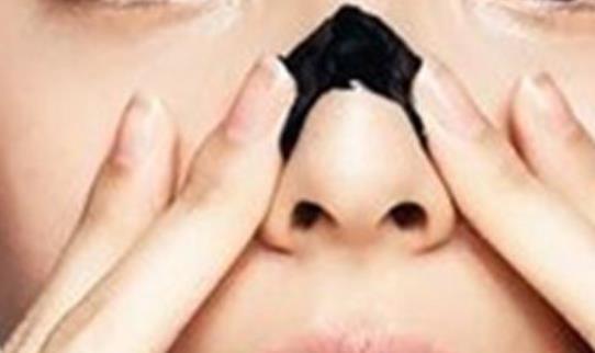 鼻尖上頑固的黑頭是每個(gè)人都有的煩惱 5個(gè)妙招快速去黑頭
