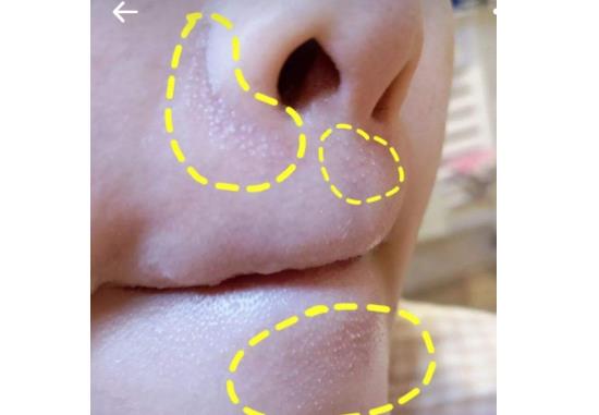 黑眼圈消不掉 肌膚老化的7大信號