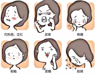 激素臉有哪些癥狀表現(xiàn)?解答激素臉反復(fù)總不好怎么辦