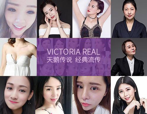 張家口維多利亞美容怎么樣 國慶整形優惠活動來襲