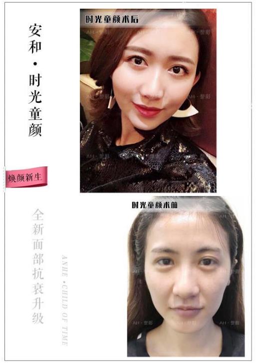 鄭州安和整形醫院評價 給了我一個明星夢