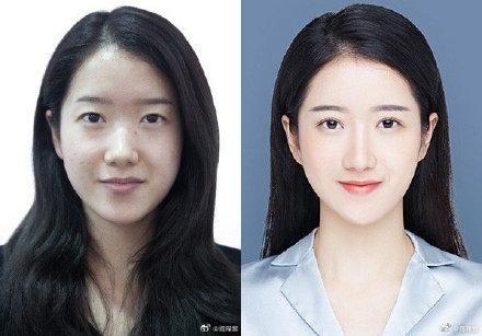 29城女子公布整容前后證件照,改變的不只是容貌更是命運