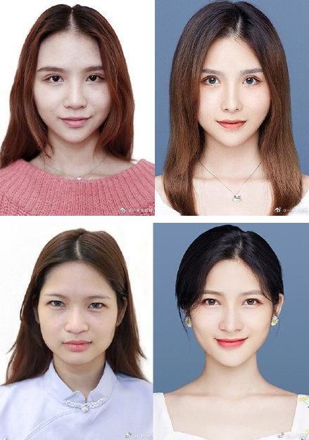 29城女子公布整容前后證件照,改變的不只是容貌更是命運