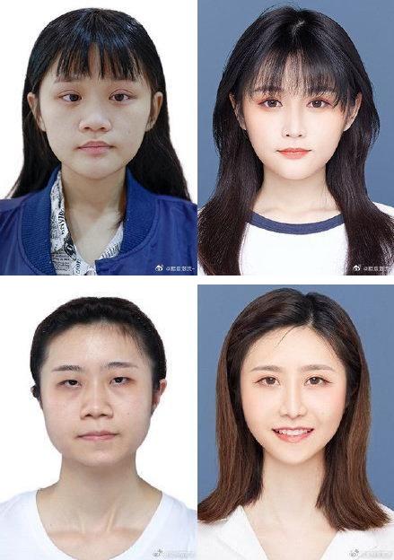 29城女子公布整容前后證件照,改變的不只是容貌更是命運