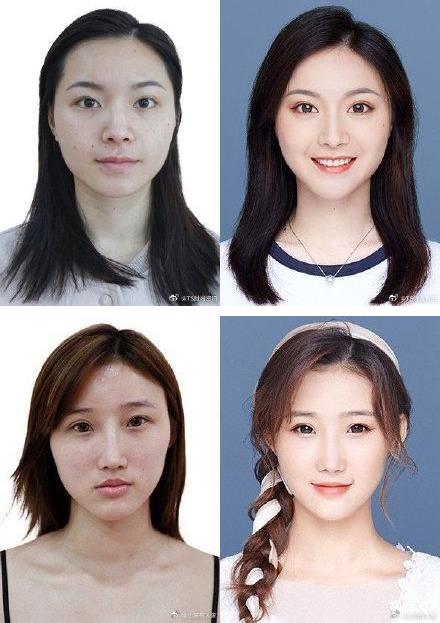 29城女子公布整容前后證件照,改變的不只是容貌更是命運