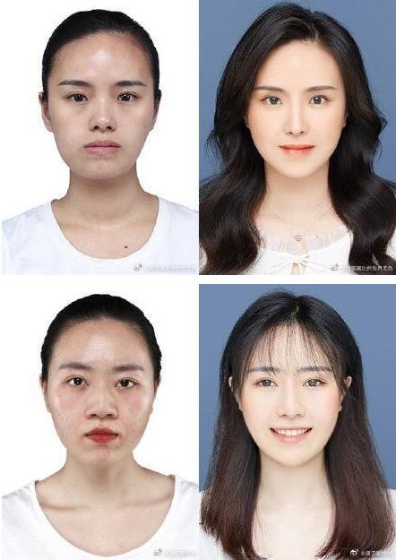 29城女子公布整容前后證件照,改變的不只是容貌更是命運