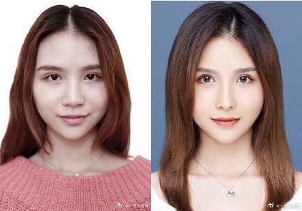 29城女子公布整容前后證件照,改變的不只是容貌更是命運