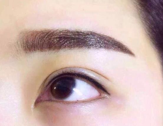 美瞳線淤青和暈色區別有哪些?紋美瞳線眼睛腫了怎么辦?