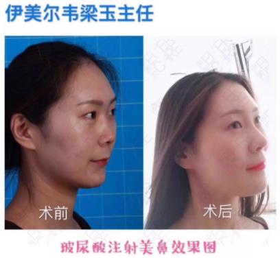 北京伊美爾愛(ài)康韋梁玉醫(yī)生靠譜嗎?喚醒嬌嫩美肌