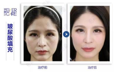 北京伊美爾愛(ài)康韋梁玉醫(yī)生靠譜嗎?喚醒嬌嫩美肌