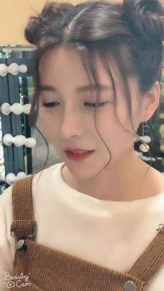廈門薇格整形醫院:玻尿酸讓她從“干癟火柴妹”變成“精致小姐姐”