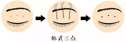 鄭州美萊整形靠譜么 重塑優美弧線靈韻精雕大眼