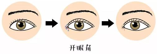 鄭州美萊整形靠譜么 重塑優美弧線靈韻精雕大眼