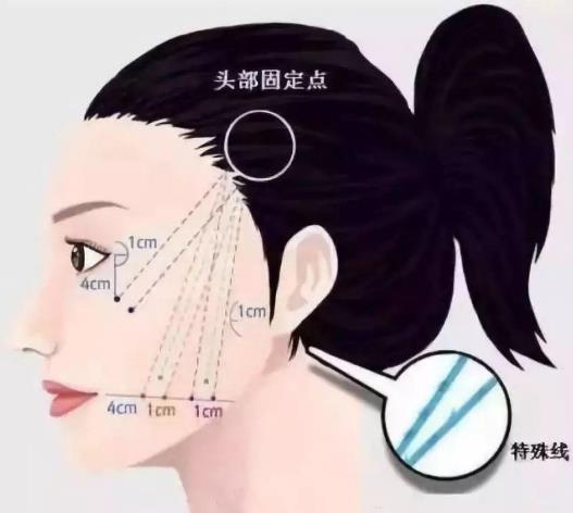 昆明藝星整形醫院可靠么 素顏女神