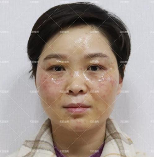 鄭州天后醫(yī)療美容醫(yī)院好嗎 點燃您的靚麗豐采