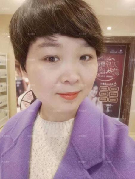 鄭州天后醫(yī)療美容醫(yī)院好嗎 點燃您的靚麗豐采