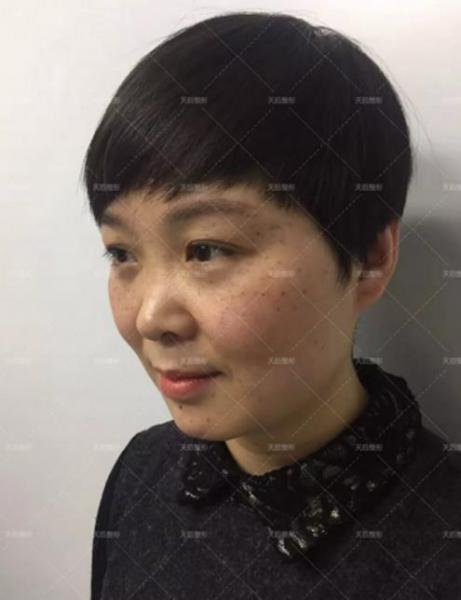 鄭州天后醫(yī)療美容醫(yī)院好嗎 點燃您的靚麗豐采