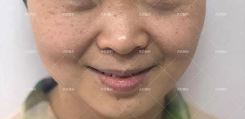 鄭州天后醫(yī)療美容醫(yī)院好嗎 點燃您的靚麗豐采