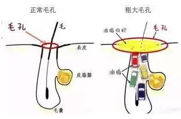 北京伊美爾愛康醫院: 點陣激光多久恢復