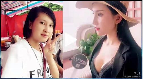 貴陽藝齡汪飛院長揭秘為什么鼻整形顯假 打造精致自然鼻