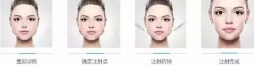 鄭州愛美麗醫院,有一種肉毒素,打了“它”,男友比原來更加愛你了!