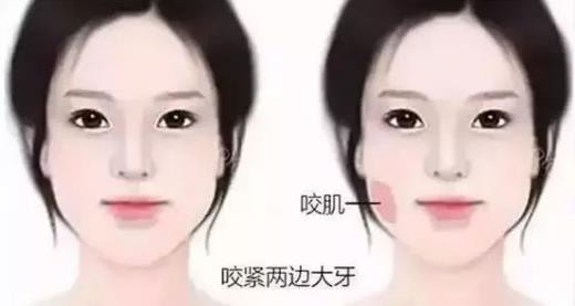 鄭州愛美麗醫院,有一種肉毒素,打了“它”,男友比原來更加愛你了!