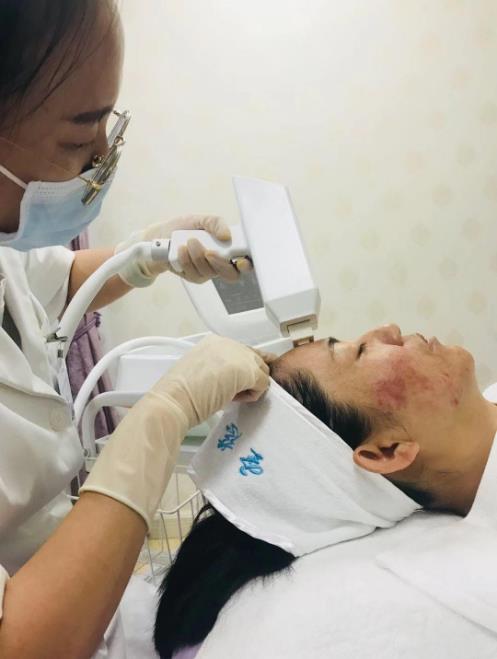 圣慈醫美——伊膚泉生物點陣射頻使肌膚更緊致,有彈性