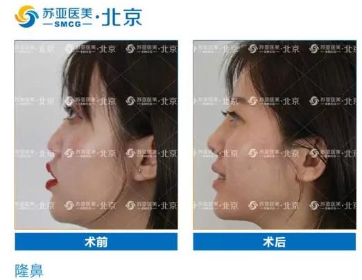 蘇亞醫美正規嗎 專注美麗關注美麗