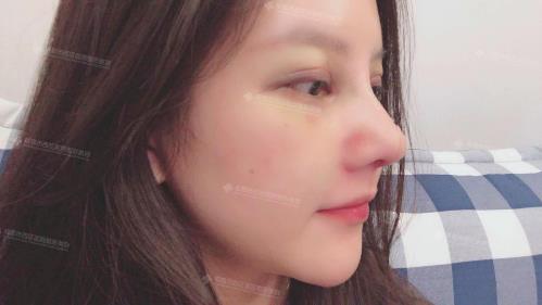 成都黃富偉這個醫(yī)生做鼻子撒樣?