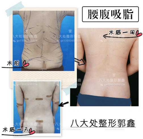 八大處整形郭鑫教授:實現普通女孩到女神的蛻變