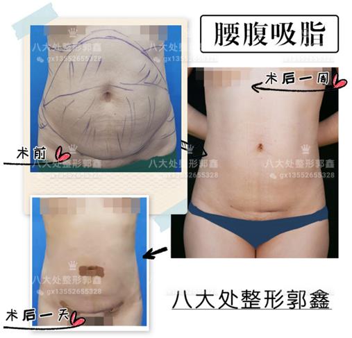 八大處整形郭鑫教授:實現普通女孩到女神的蛻變